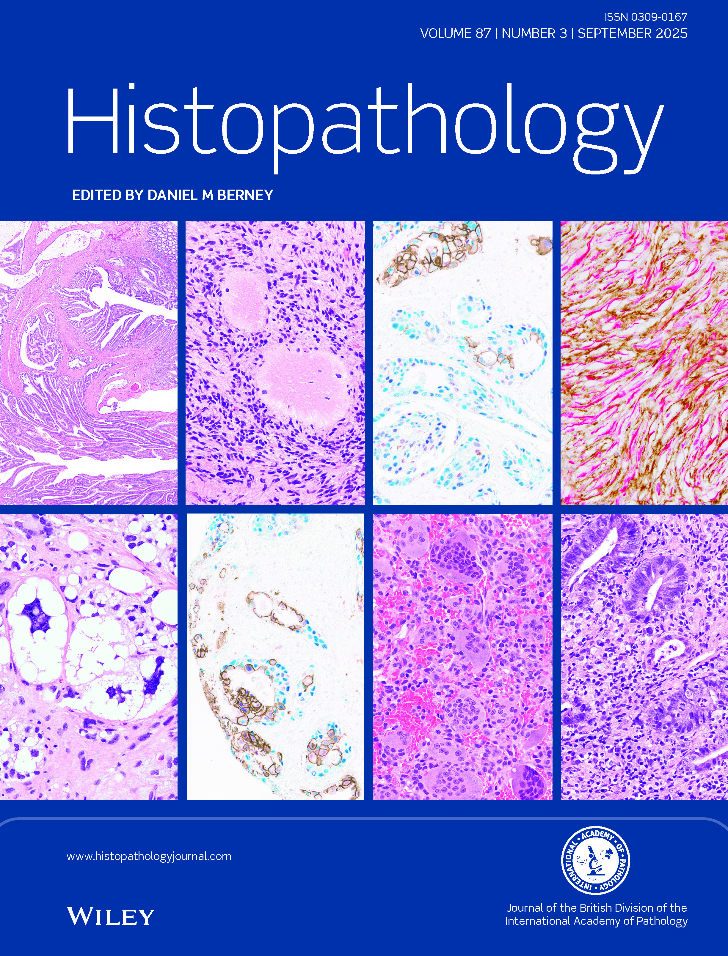 Histopathology: Vol 87, No 3